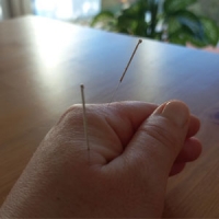 Wizyta akupunkturowa