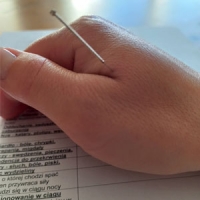 Pierwsza Wizyta Akupunkturowa